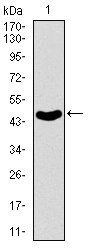 ABCB5 Antibody