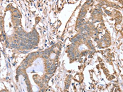 ABCB6 antibody