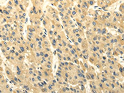 ABCB7 Antibody
