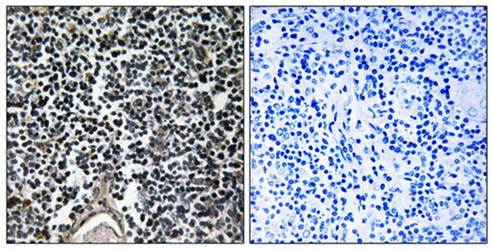 ABCB7 Antibody