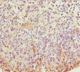 ABCB8 Antibody