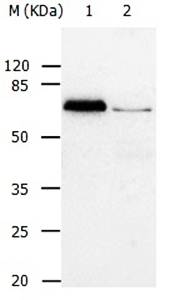 ABCB8 Antibody