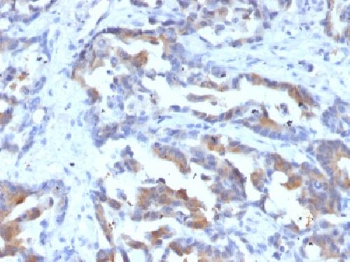 MRP1 / ABCC1 (Multidrug Resistance Related Protein 1) Antibody