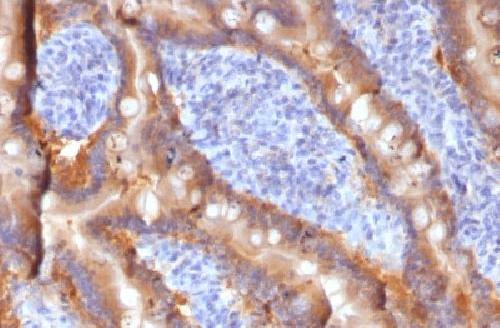 MRP1 / ABCC1 (Multidrug Resistance Related Protein 1) Antibody