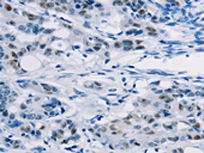 ABCC1 Antibody