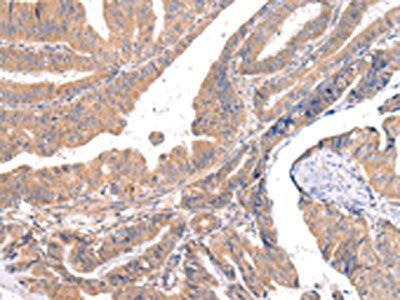 ABCC1 Antibody