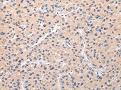 ABCC1 Antibody