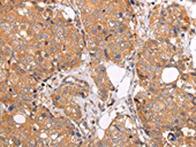 ABCC1 Antibody