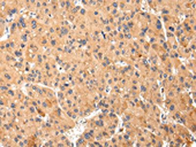 ABCC1 Antibody
