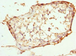 ABCC11 antibody