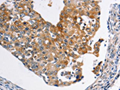 ABCC3 Antibody