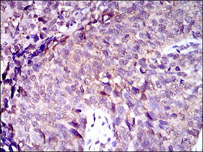 ABCC4 Antibody