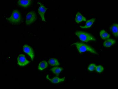 ABCC6 Antibody