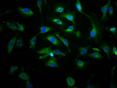 ABCC8 Antibody