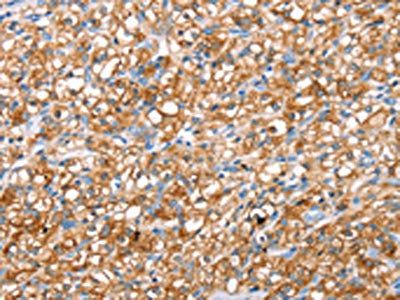 ABCC8 Antibody