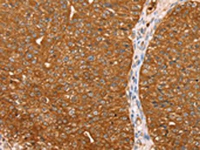 ABCC8 Antibody