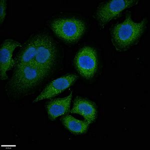 ABCC9 antibody