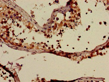 ABCC9 Antibody