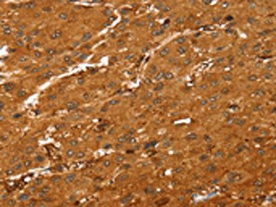 ABCC9 Antibody