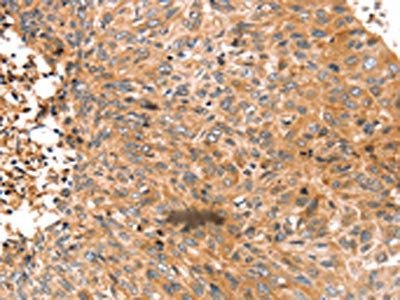 ABCC9 Antibody