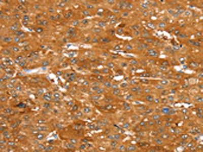 ABCC9 Antibody