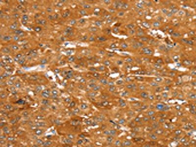 ABCC9 antibody