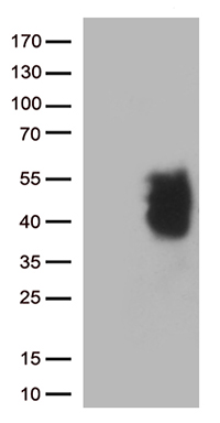 ABCD1 Antibody