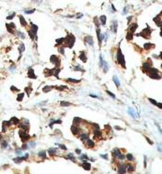 ABCD1 antibody