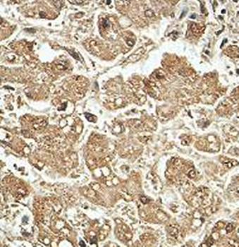 ABCD3 Rabbit Polyclonal Antibody