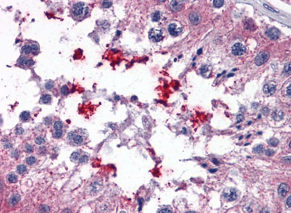 Goat anti-ABCD4 Antibody