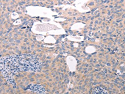 ABCF1 Antibody