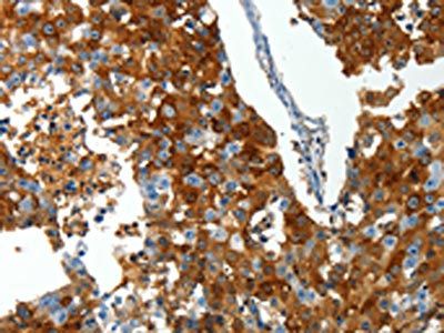 ABCG1 Antibody