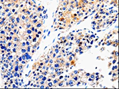 ABCG2 Antibody