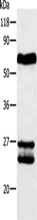 ABCG2 Antibody