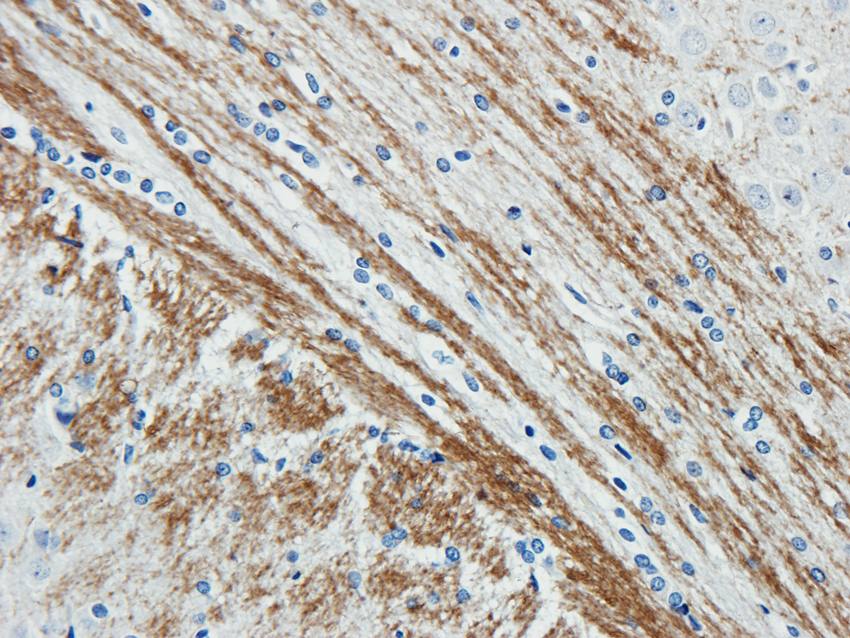 ABCG2 antibody