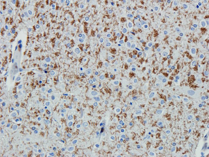 ABCG2 antibody