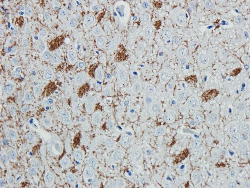 ABCG2 antibody