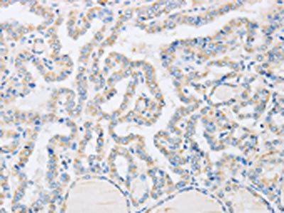 ABHD1 Antibody