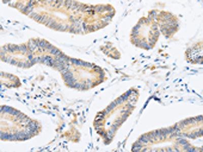 ABHD1 Antibody