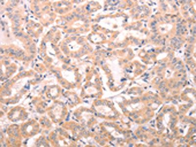 ABHD12 antibody