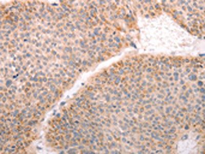 ABHD12 antibody