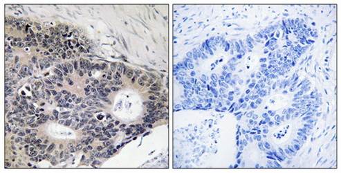 ABHD12B Antibody