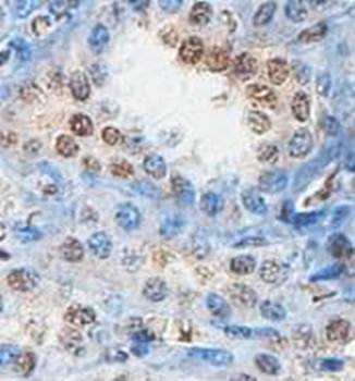ABHD12B Rabbit Polyclonal Antibody