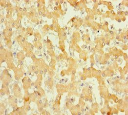 ABHD14B Antibody
