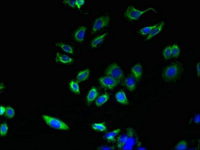 ABHD3 Antibody