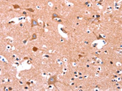 ABI1 Antibody