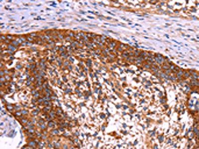 ABI1 Antibody