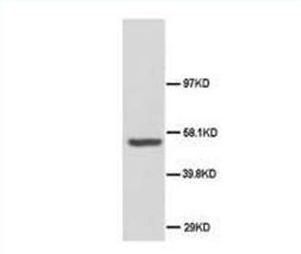 SSH3BP1/ABI1 Antibody