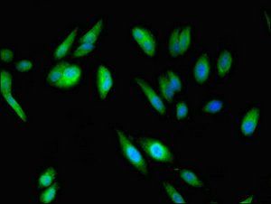 ABI2 Antibody