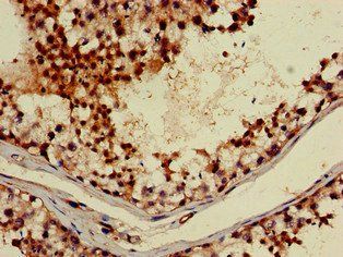 ABI2 Antibody